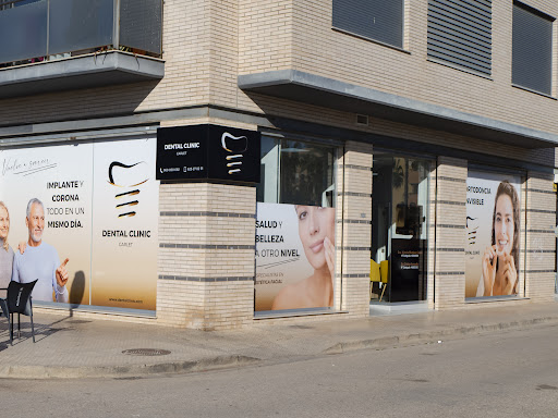 Dental Clinic Carlet - Implantes Dentales - Ortodoncia
