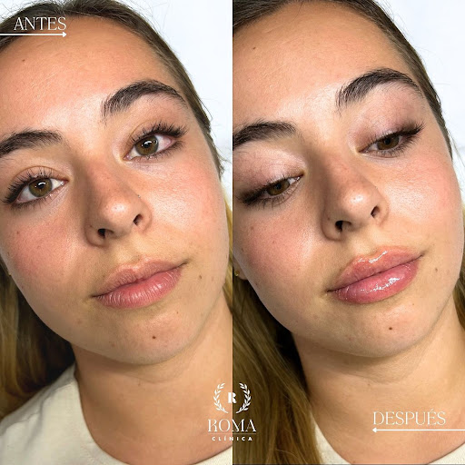 Clínica Roma - Medicina Estética Málaga